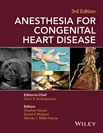 Anesthesia for Congenital Heart Disease. Группа авторов