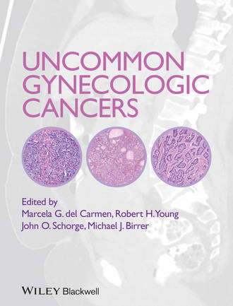 Группа авторов. Uncommon Gynecologic Cancers