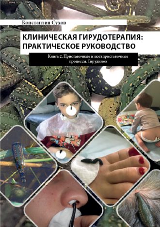 Клиническая гирудотерапия: практическое руководство. Книга 2 Приставочные и постприставочные процессы. Гирудиноз. 