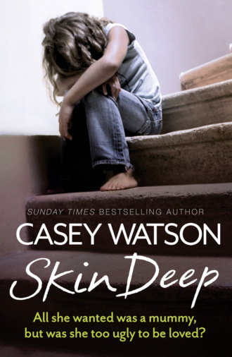 Casey  Watson. Skin Deep: All She Wanted Was a Mummy, But Was She Too Ugly to Be Loved?