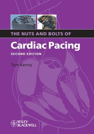 Tom  Kenny. The Nuts and Bolts of Cardiac Pacing