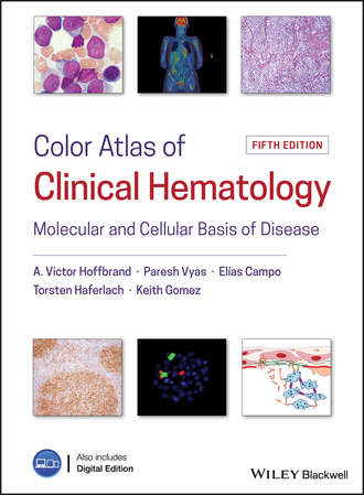 Elias  Campo. Color Atlas of Clinical Hematology. Molecular and Cellular Basis of Disease