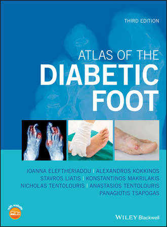 Panagiotis  Tsapogas. Atlas of the Diabetic Foot