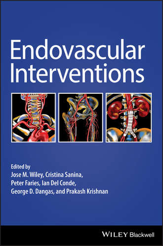 Endovascular Interventions. Prakash  Krishnan