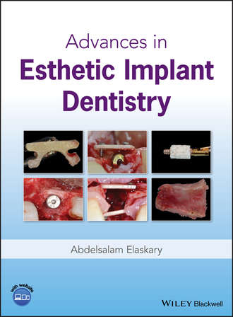Abdelsalam Elaskary. Advances in Esthetic Implant Dentistry