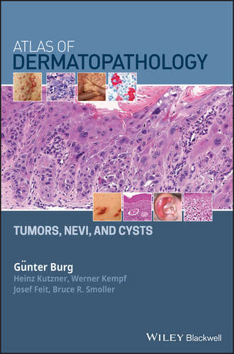 Werner  Kempf. Atlas of Dermatopathology