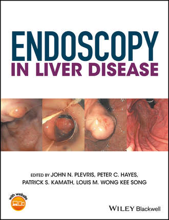 Группа авторов. Endoscopy in Liver Disease