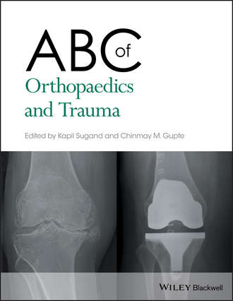 Kapil  Sugand. ABC of Orthopaedics and Trauma