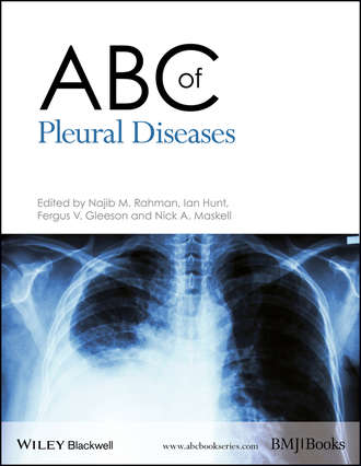 Ian  Hunt. ABC of Pleural Diseases