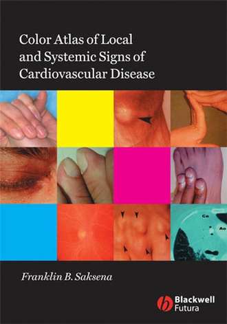 Группа авторов. Color Atlas of Local and Systemic Manifestations of Cardiovascular Disease
