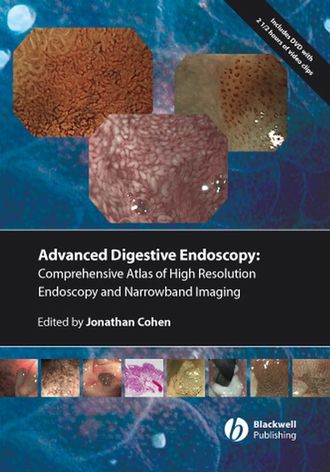 Группа авторов. Comprehensive Atlas of High Resolution Endoscopy and Narrowband Imaging