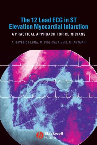 Miquel Fiol-Sala. The 12 Lead ECG in ST Elevation Myocardial Infarction
