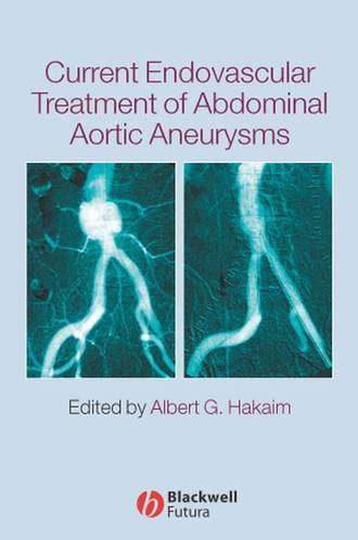 Группа авторов. Current Endovascular Treatment of Abdominal Aortic Aneurysms