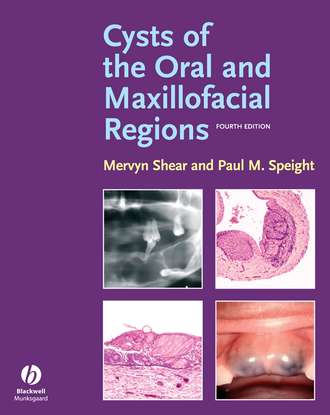 Mervyn  Shear. Cysts of the Oral and Maxillofacial Regions