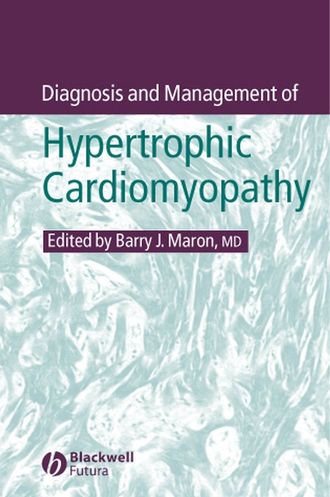 Группа авторов. Diagnosis and Management of Hypertrophic Cardiomyopathy