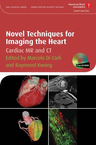 Marcelo Carli F.Di. Novel Techniques for Imaging the Heart