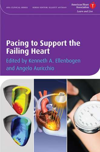 Pacing to Support the Failing Heart. Angelo  Auricchio