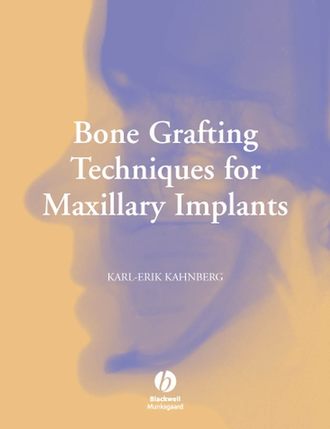 Bone Grafting Techniques for Maxillary Implants. Группа авторов