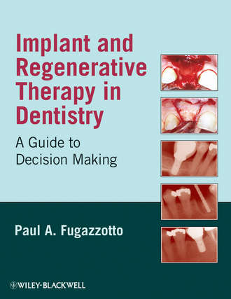 Группа авторов. Implant and Regenerative Therapy in Dentistry