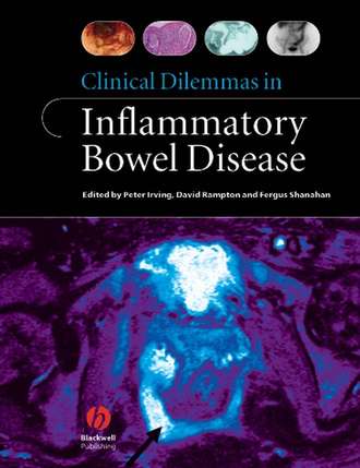 Fergus Shanahan. Clinical Dilemmas in Inflammatory Bowel Disease