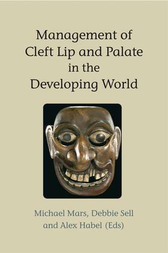 Michael  Mars. Management of Cleft Lip and Palate in the Developing World