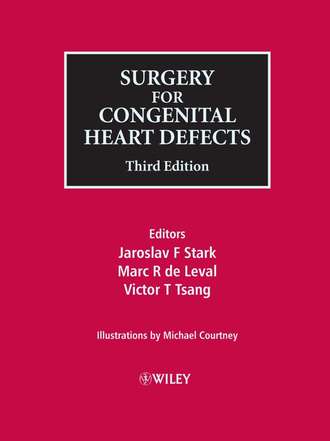 Michael  Courtney. Surgery for Congenital Heart Defects