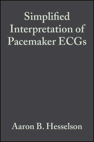 Группа авторов. Simplified Interpretation of Pacemaker ECGs
