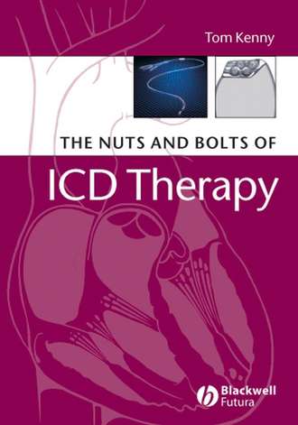 Группа авторов. The Nuts and Bolts of ICD Therapy