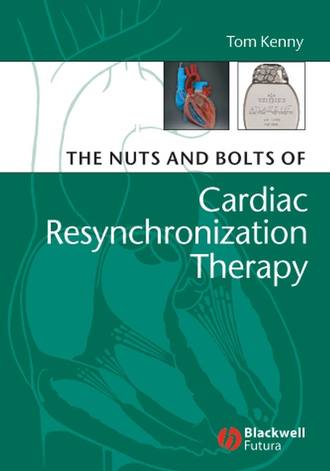 Группа авторов. The Nuts and Bolts of Cardiac Resynchronization Therapy