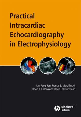 Jian-Fang  Ren. Practical Intracardiac Echocardiography in Electrophysiology