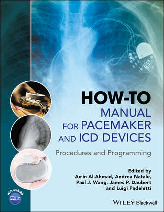 Andrea  Natale. How-to Manual for Pacemaker and ICD Devices