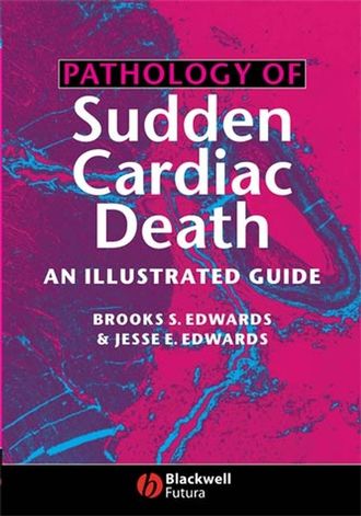 Brooks Edwards S.. Pathology of Sudden Cardiac Death