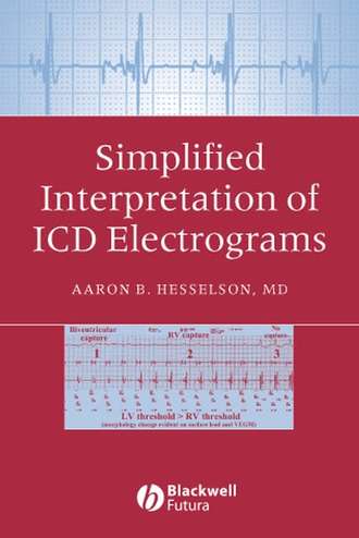 Группа авторов. Simplified Interpretation of ICD Electrograms