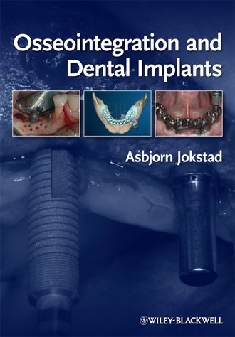 Группа авторов. Osseointegration and Dental Implants