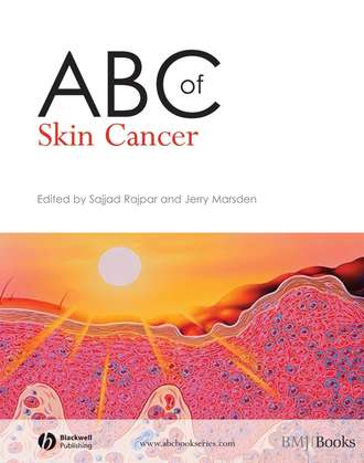 Sajjad  Rajpar. ABC of Skin Cancer