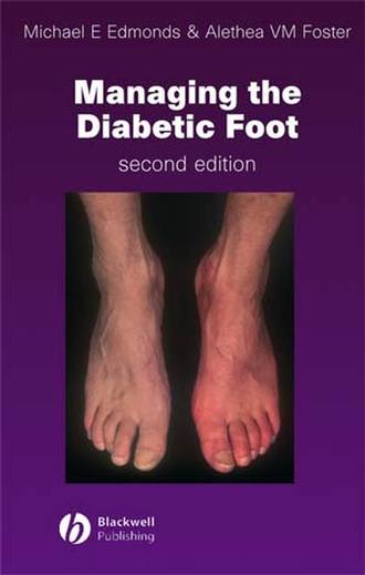 Michael E. Edmonds. Managing the Diabetic Foot