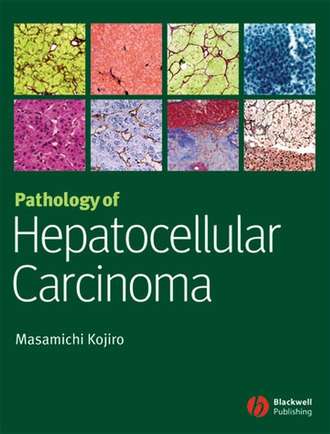 Группа авторов. Pathology of Hepatocellular Carcinoma