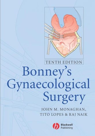 Tito  Lopes. Bonney's Gynaecological Surgery