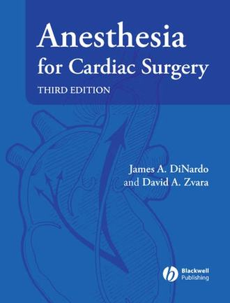 James DiNardo A.. Anesthesia for Cardiac Surgery