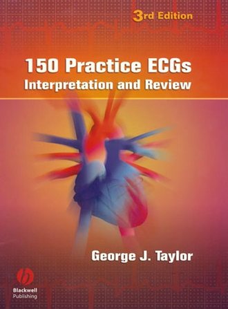 Группа авторов. 150 Practice ECGs
