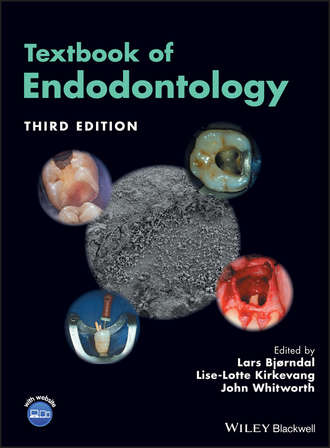 Lise-Lotte  Kirkevang. Textbook of Endodontology