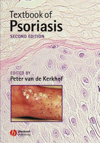 Peter C. M. van de Kerkhof. Textbook of Psoriasis