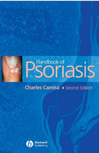 Группа авторов. Handbook of Psoriasis