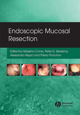 Massimo  Conio. Endoscopic Mucosal Resection