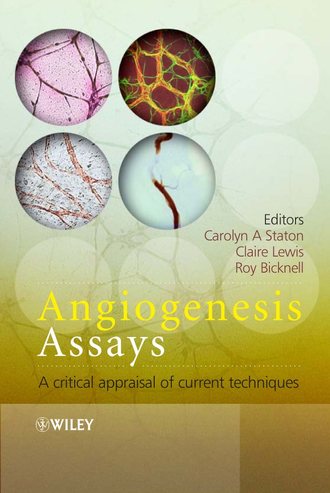 Claire  Lewis. Angiogenesis Assays