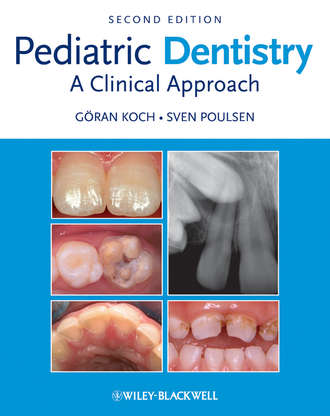 Goran  Koch. Pediatric Dentistry