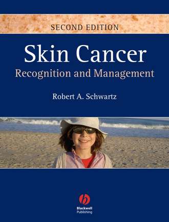 Группа авторов. Skin Cancer