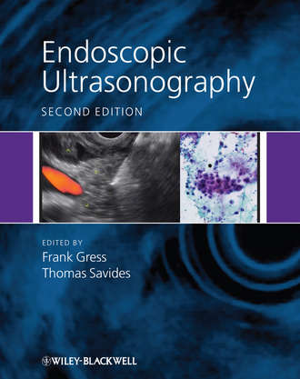 Thomas Savides J.. Endoscopic Ultrasonography