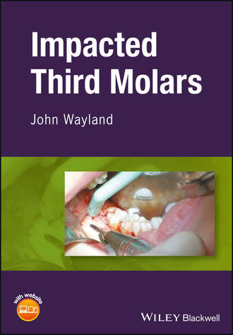 Группа авторов. Impacted Third Molars