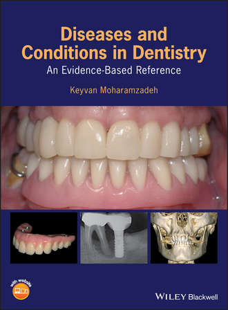 Группа авторов. Diseases and Conditions in Dentistry